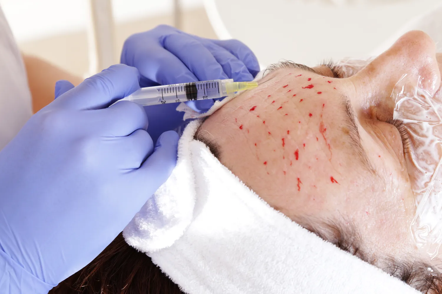 Medycyna estetyczna jak zostać?