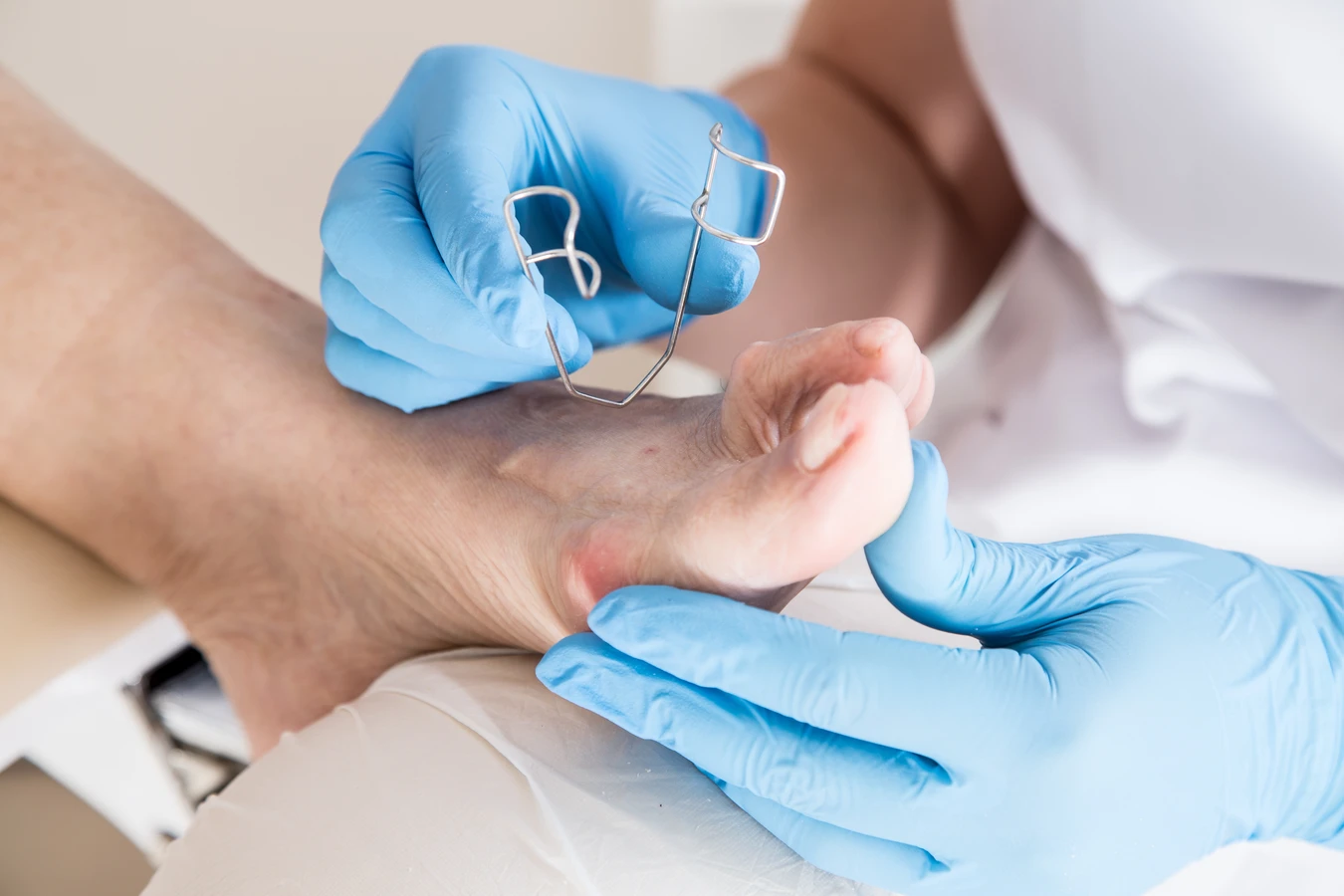 Pedicure leczniczy - czym jest i na jakie efekty możesz liczyć?