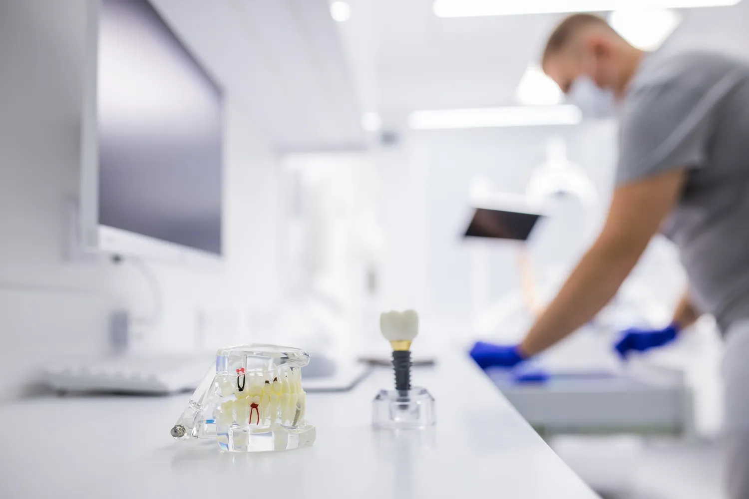 Cena implantu zęba Warszawa