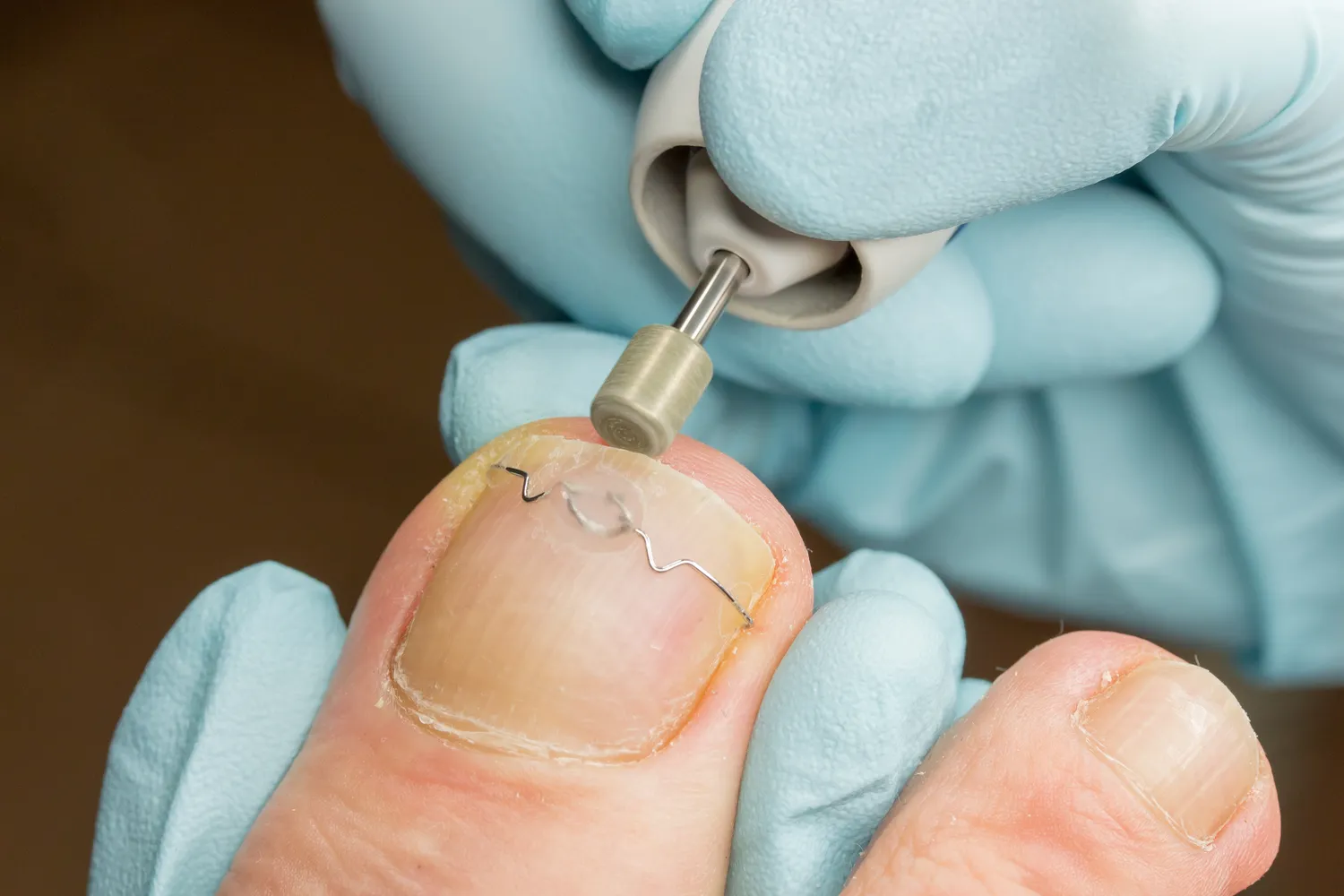 Podolog radzi - jak przygotować stopy na wiosnę