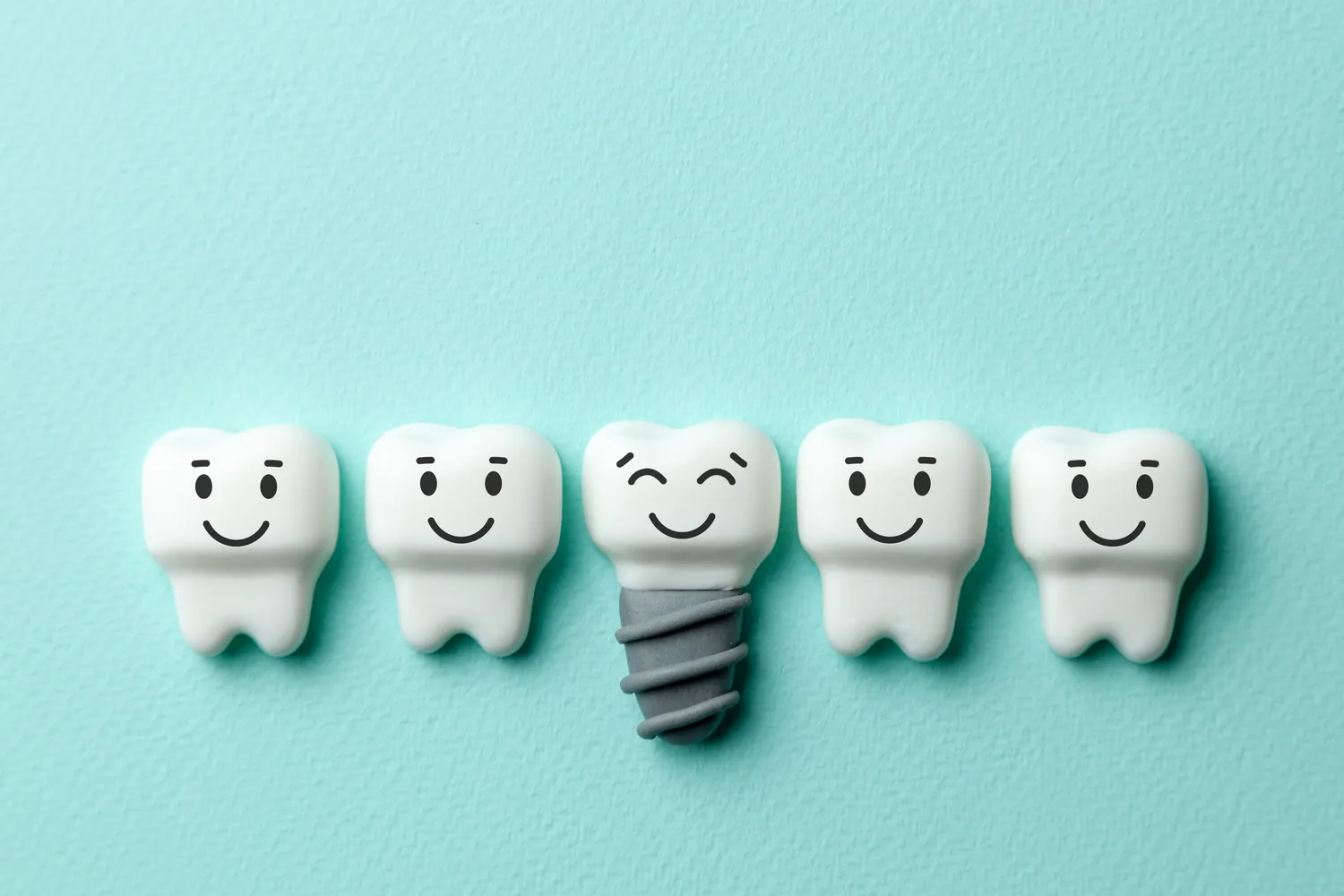 Implanty zębów - ich wady i zalety